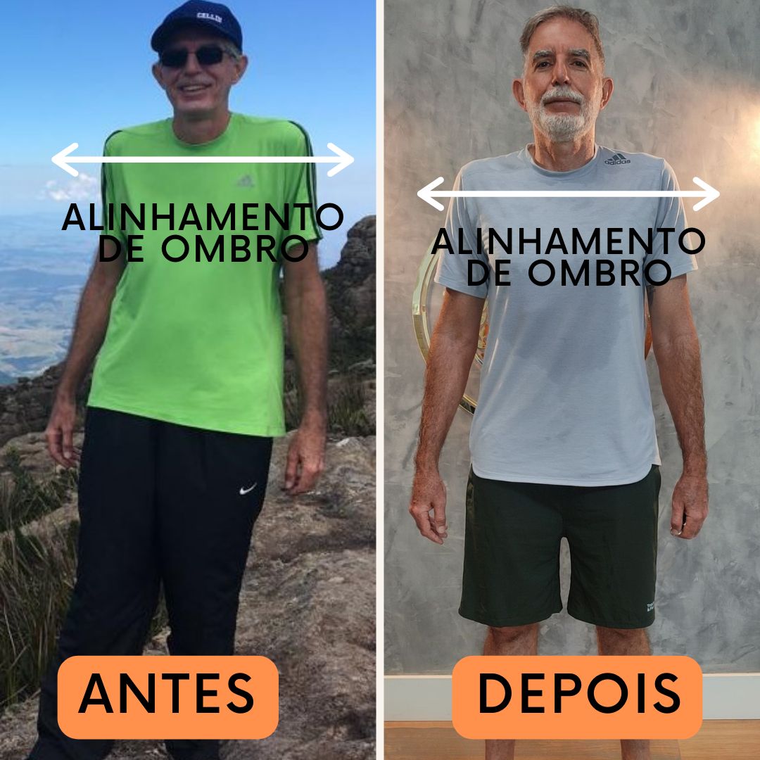 Antes e depois de alinhamento dos ombros